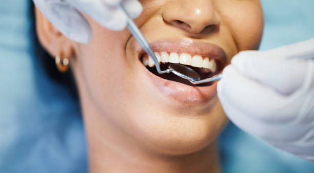 Best Emergency Dental Care for Abscessed Tooth in Secaucus, NJ